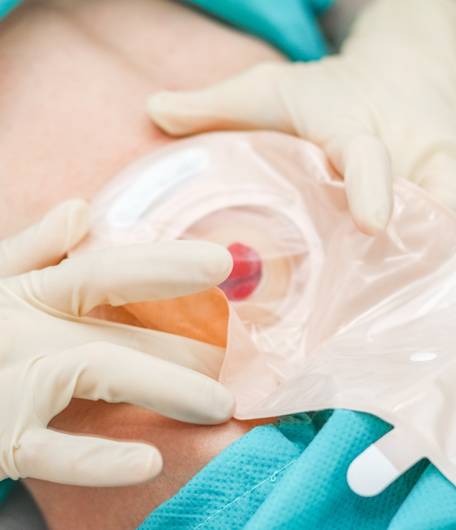 Thuisverpleging Annick Meulders - Stomazorg Westerlo